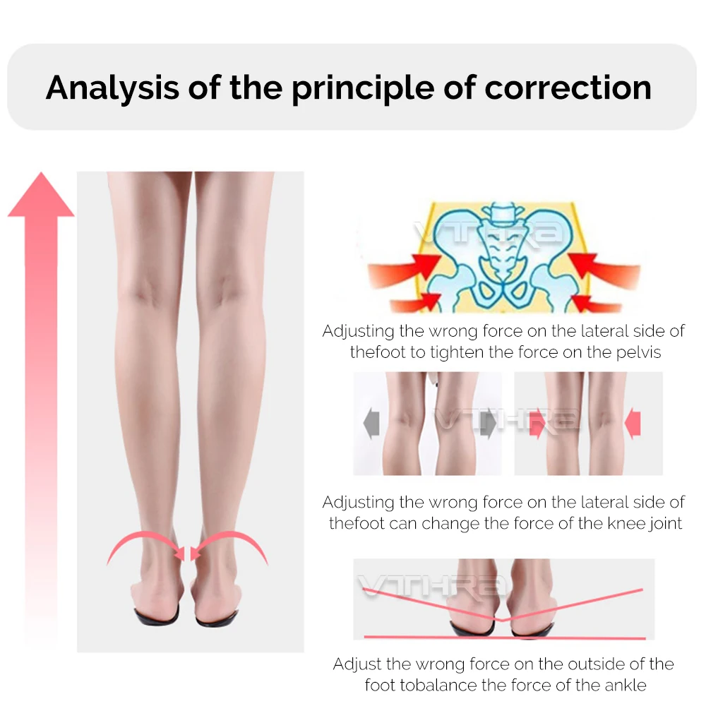 OX Leg Orthotics Cubitus Varus half flat foot Insole Orthopedic Insoles for Shoes insert Arch Support pad for plantar fasciitis detail