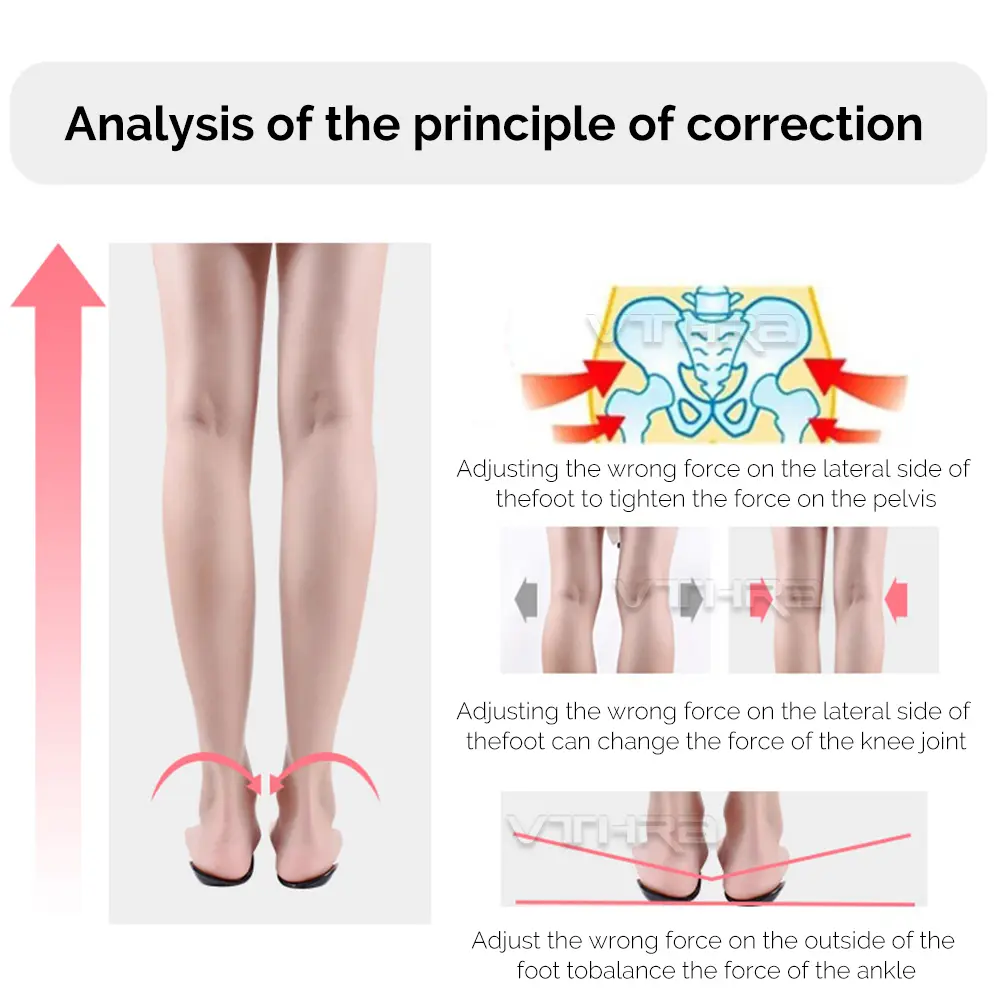 OX Leg Orthotics Cubitus Varus half flat foot Insole Orthopedic Insoles for Shoes insert Arch Support pad for plantar fasciitis product view