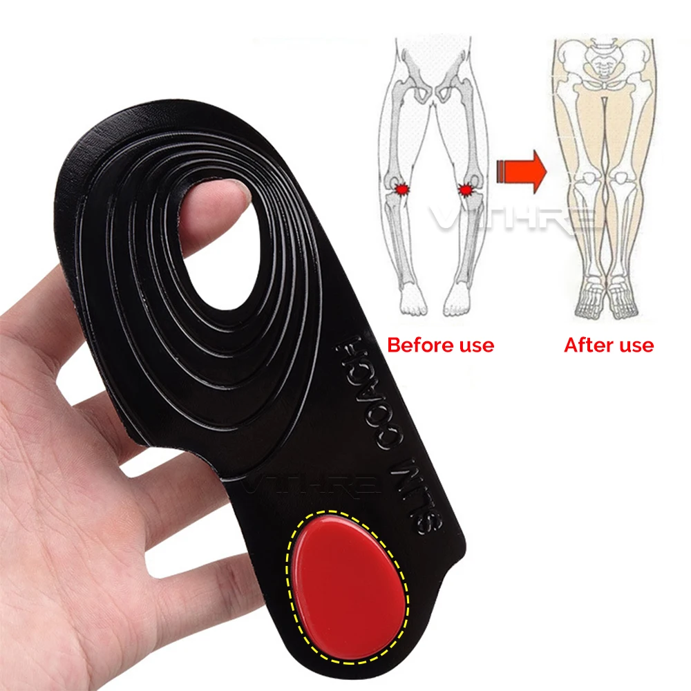 OX Leg Orthotics Cubitus Varus half flat foot Insole Orthopedic Insoles for Shoes insert Arch Support pad for plantar fasciitis detail