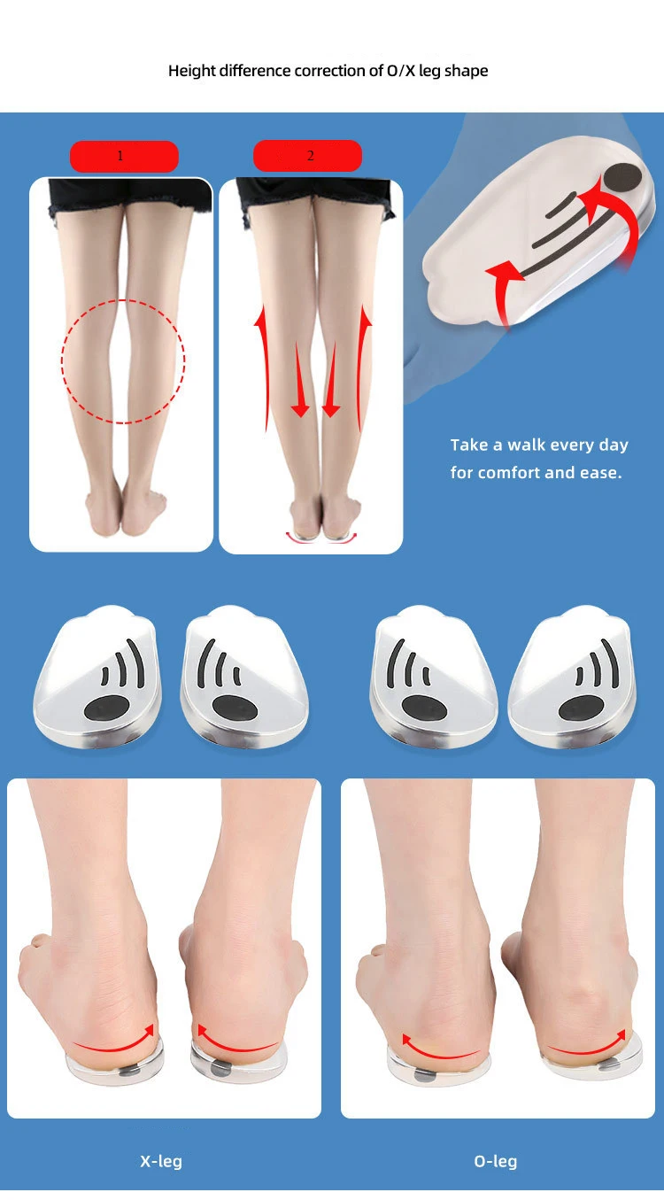 O/X Leg Type Valgus Varus Correction Plantar Fasciitis Gel Insole Magnet Massage Foot Care Silicone Orthopedic Insoles for Feet detail