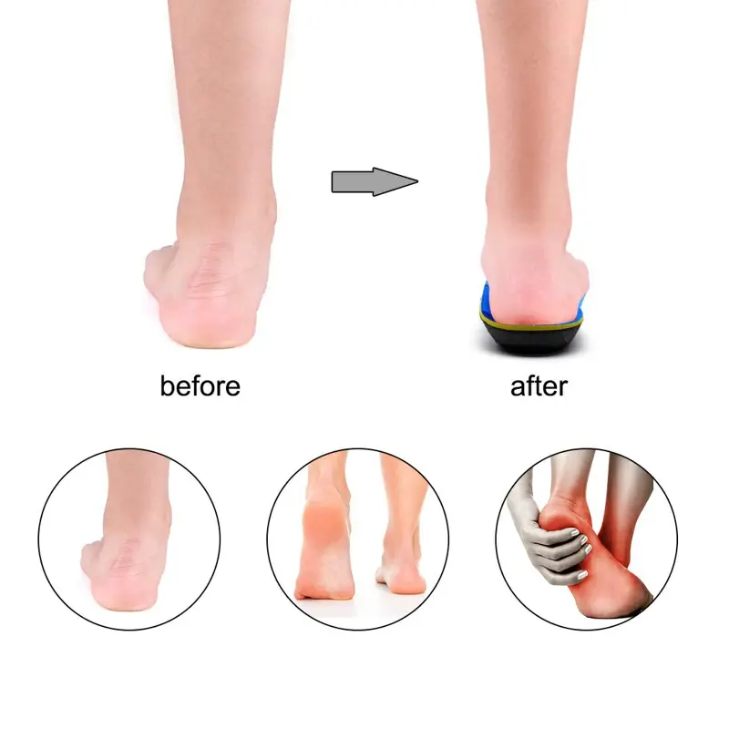 IFITNA Flat Feet Orthopedic Insoles Arch Support Template Plantar Fasciitis Orthotics Heel Pain Inserts Boots Sneaker Men Women product view